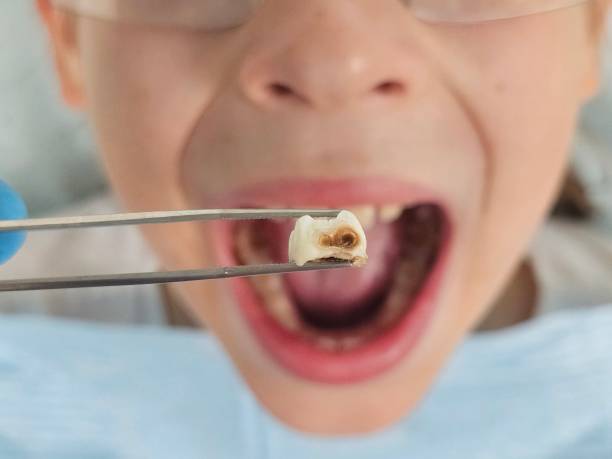 Best After-Hours Dental Trauma Care in Anthem, AZ